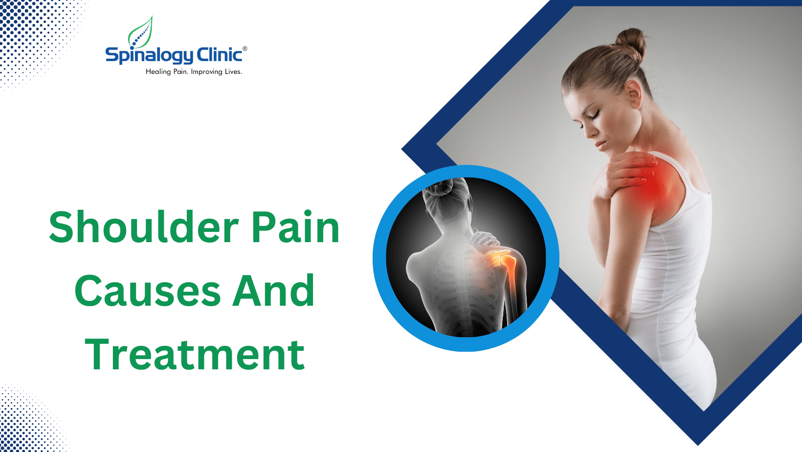 Shoulder Pain Causes And Treatment